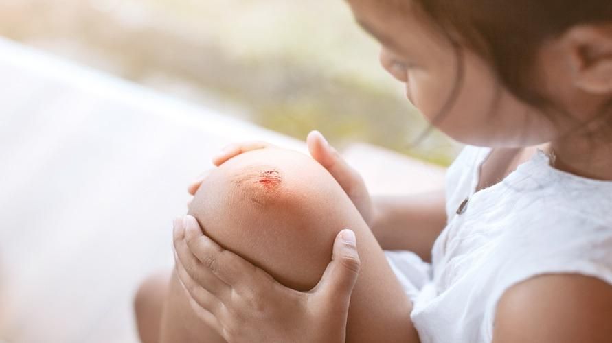 Cara Mengobati Luka Pada Anak Tanpa Obat Merah Budsorganics Babyempire (1)